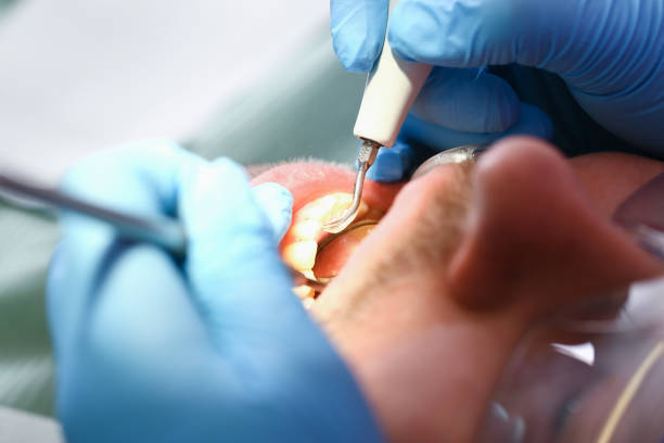 Best Same-Day Emergency Dental Services in Country Club Hls, IL