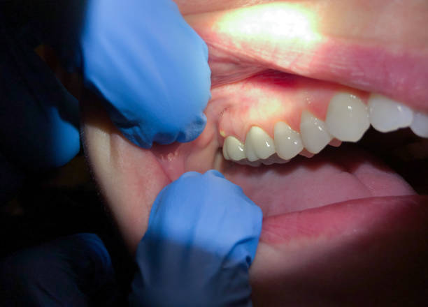 Best After-Hours Dental Trauma Care in Country Club Hls, IL