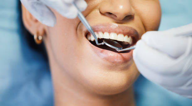 Best Emergency Gum Treatment in Country Club Hls, IL